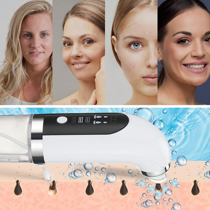 Electric Blackhead Remover