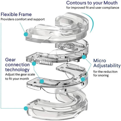 Essenley - Anti Snoring Mouth Guard