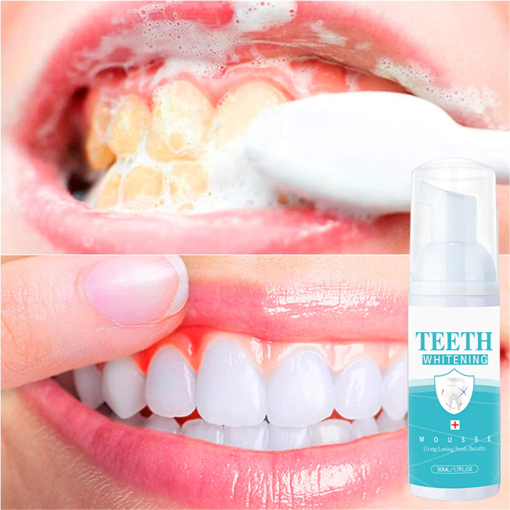 Essenley - Advanced Teeth Whitening Toothpaste